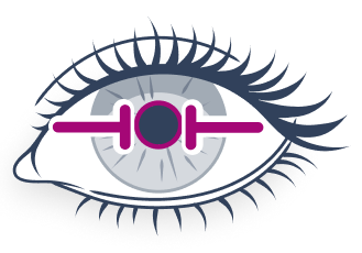Brimonidine for treating pupil dilation